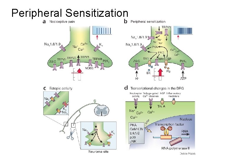 Peripheral Sensitization 