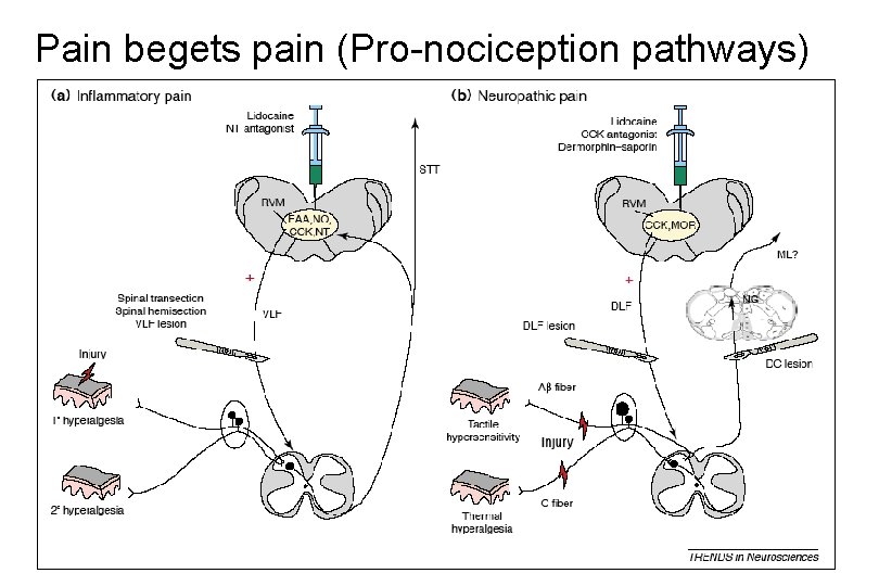 Pain begets pain (Pro-nociception pathways) 