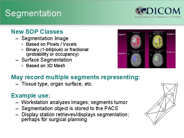 Segmentation New SOP Classes – Segmentation Image • Based on Pixels / Voxels •