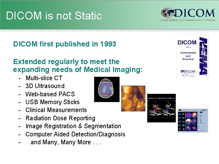 DICOM is not Static DICOM first published in 1993 Extended regularly to meet the