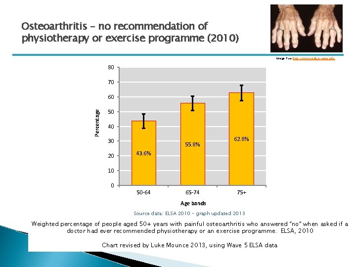 Osteoarthritis – no recommendation of physiotherapy or exercise programme (2010) Image from http: //www.