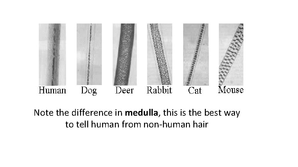 Note the difference in medulla, this is the best way to tell human from Note the difference in medulla, this is the best way to tell human from