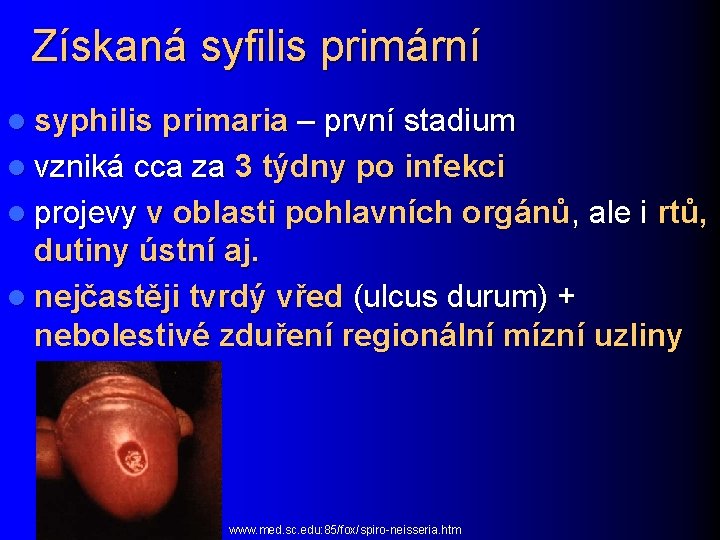 Získaná syfilis primární l syphilis primaria – první stadium l vzniká cca za 3