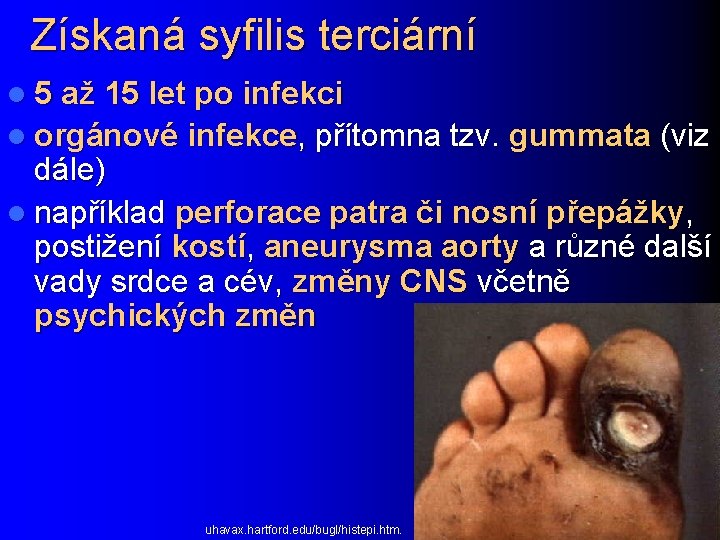 Získaná syfilis terciární l 5 až 15 let po infekci l orgánové infekce, přítomna