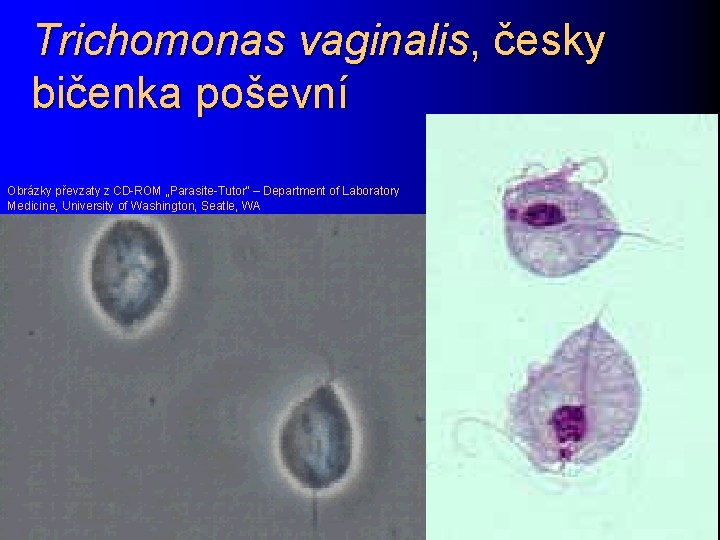 Trichomonas vaginalis, česky bičenka poševní Obrázky převzaty z CD-ROM „Parasite-Tutor“ – Department of Laboratory