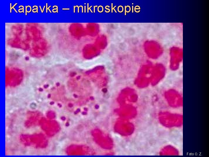 Kapavka – mikroskopie Foto O. Z. 