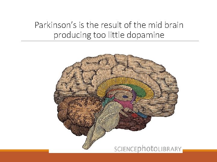 Parkinson’s is the result of the mid brain producing too little dopamine 