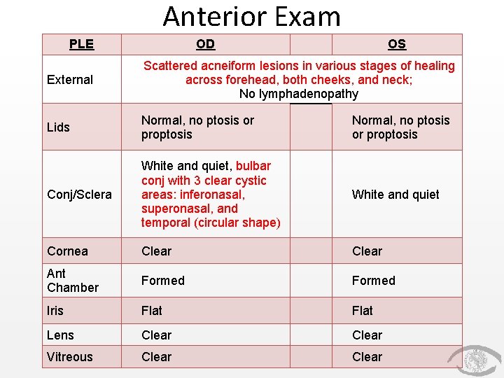 Anterior Exam PLE OD OS External Scattered acneiform lesions in various stages of healing Anterior Exam PLE OD OS External Scattered acneiform lesions in various stages of healing