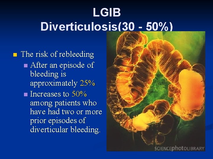 LGIB Diverticulosis(30 - 50%) n The risk of rebleeding n After an episode of