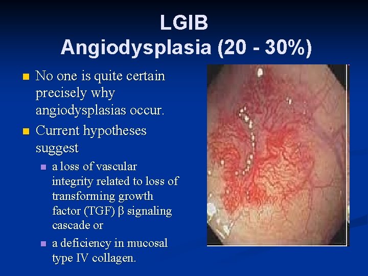 LGIB Angiodysplasia (20 - 30%) n n No one is quite certain precisely why