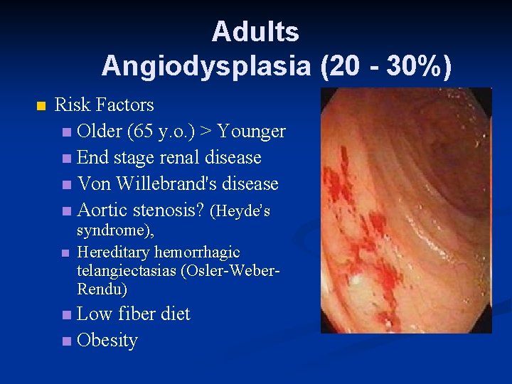 Adults Angiodysplasia (20 - 30%) n Risk Factors n Older (65 y. o. )