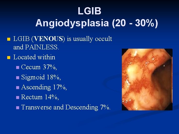 LGIB Angiodysplasia (20 - 30%) n n LGIB (VENOUS) is usually occult and PAINLESS.