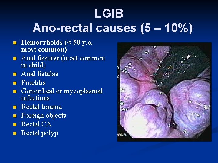LGIB Ano-rectal causes (5 – 10%) n n n n n Hemorrhoids (< 50