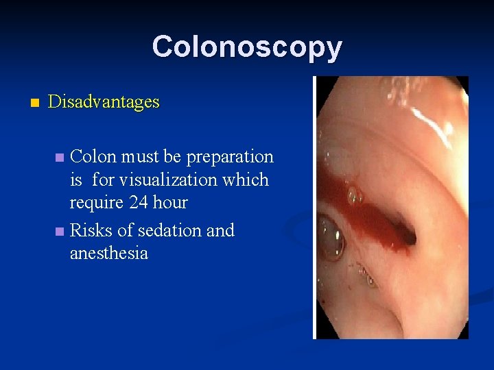 Colonoscopy n Disadvantages Colon must be preparation is for visualization which require 24 hour