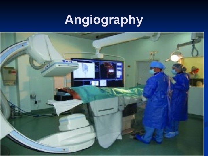 Angiography 