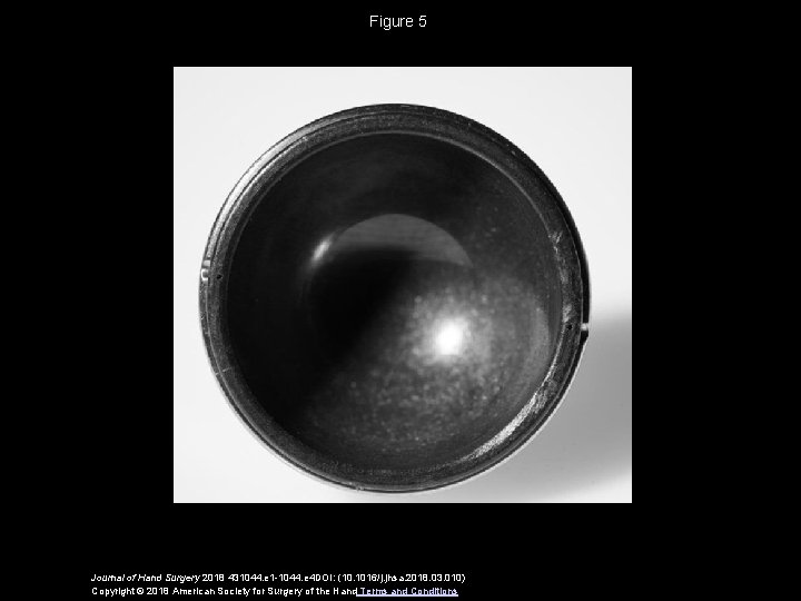 Figure 5 Journal of Hand Surgery 2018 431044. e 1 -1044. e 4 DOI: