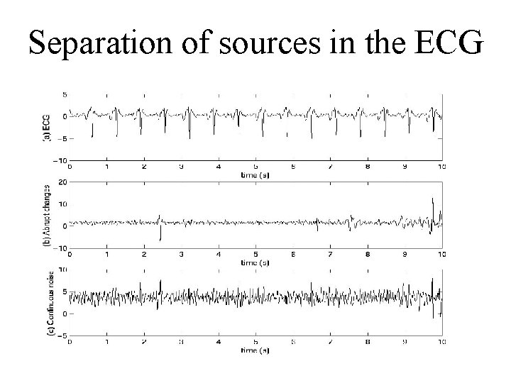 Separation of sources in the ECG 