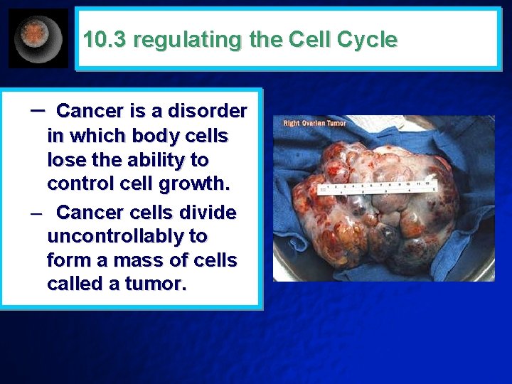 10. 3 regulating the Cell Cycle – Cancer is a disorder in which body
