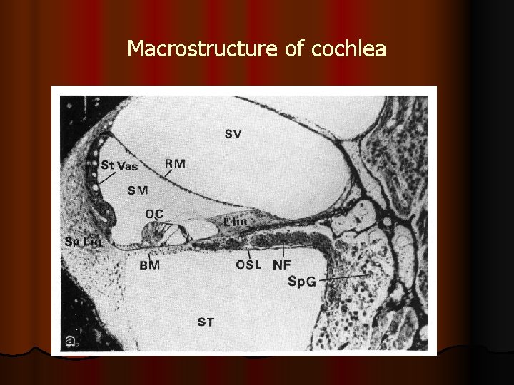 Macrostructure of cochlea 