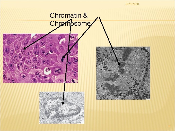 9/25/2020 Chromatin & Chromosome 6 
