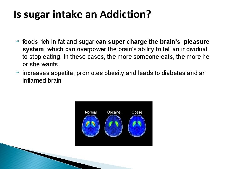Is sugar intake an Addiction? foods rich in fat and sugar can super charge Is sugar intake an Addiction? foods rich in fat and sugar can super charge