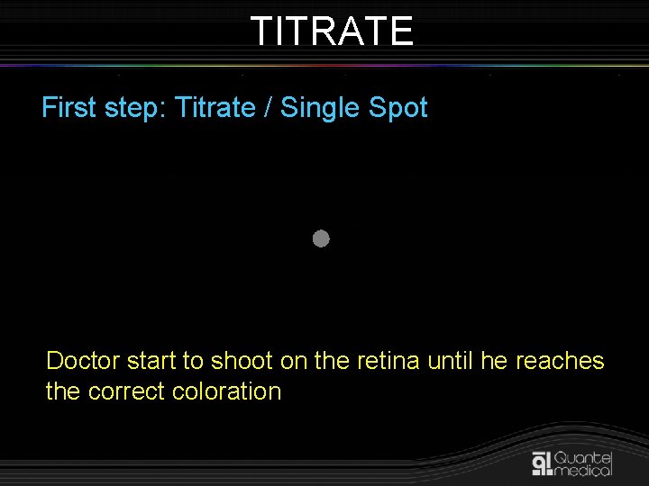 TITRATE First step: Titrate / Single Spot Doctor start to shoot on the retina