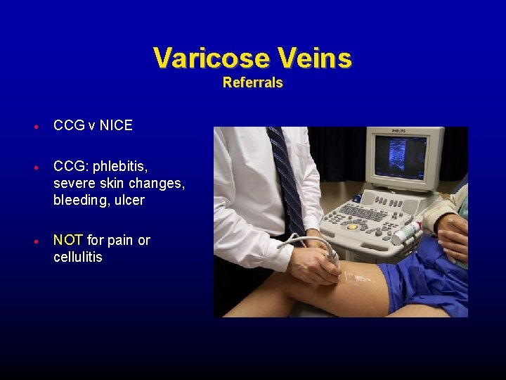 Varicose Veins Referrals CCG v NICE CCG: phlebitis, severe skin changes, bleeding, ulcer NOT