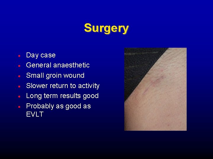 Surgery Day case General anaesthetic Small groin wound Slower return to activity Long term