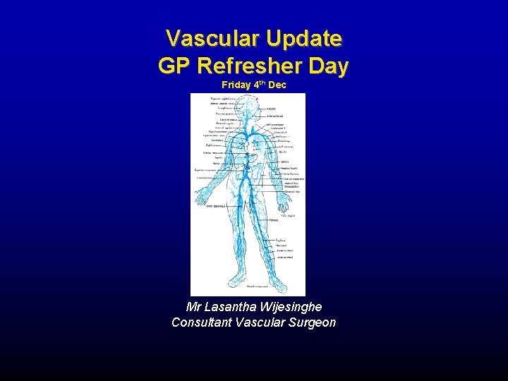 Vascular Update GP Refresher Day Friday 4 th Dec Mr Lasantha Wijesinghe Consultant Vascular