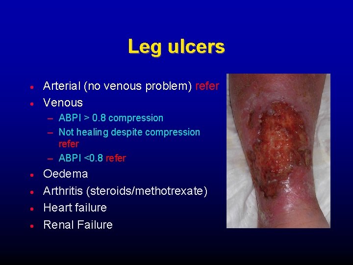 Leg ulcers Arterial (no venous problem) refer Venous – ABPI > 0. 8 compression