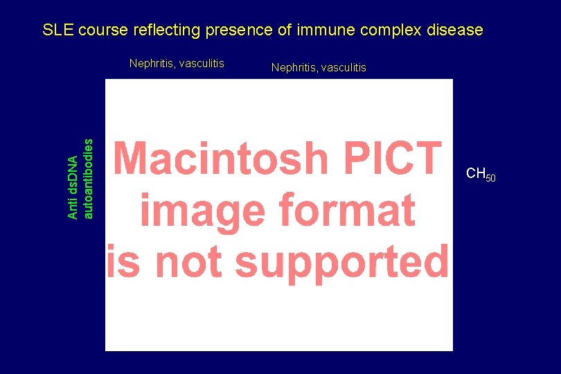 SLE course reflecting presence of immune complex disease Anti ds. DNA autoantibodies Nephritis, vasculitis