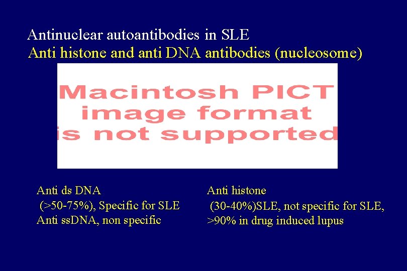 Antinuclear autoantibodies in SLE Anti histone and anti DNA antibodies (nucleosome) Anti ds DNA