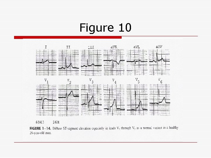 Figure 10 