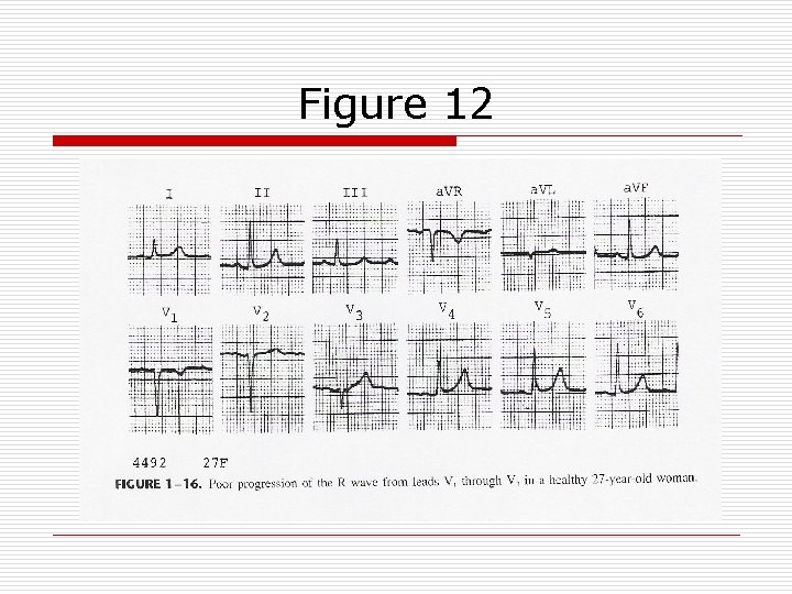 Figure 12 