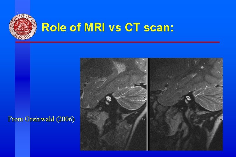 Role of MRI vs CT scan: From Greinwald (2006) Division of Otolaryngology ~ Head Role of MRI vs CT scan: From Greinwald (2006) Division of Otolaryngology ~ Head