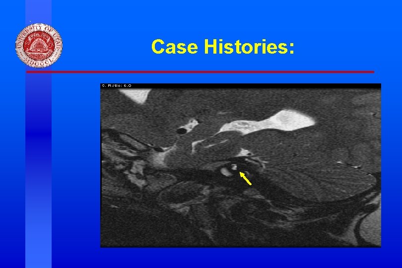 Case Histories: Division of Otolaryngology ~ Head & Neck Surgery, University of Utah 