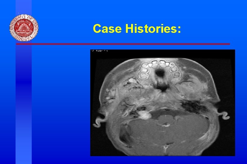Case Histories: Division of Otolaryngology ~ Head & Neck Surgery, University of Utah Case Histories: Division of Otolaryngology ~ Head & Neck Surgery, University of Utah