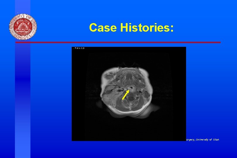 Case Histories: Division of Otolaryngology ~ Head & Neck Surgery, University of Utah 