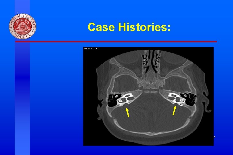 Case Histories: Division of Otolaryngology ~ Head & Neck Surgery, University of Utah Case Histories: Division of Otolaryngology ~ Head & Neck Surgery, University of Utah