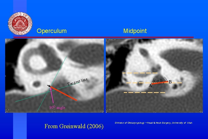 Operculum Midpoint ent Tang line A A=B B 90 O angle From Greinwald (2006)