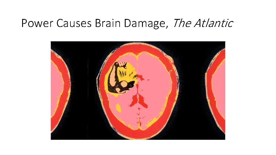 Power Causes Brain Damage, The Atlantic Power Causes Brain Damage, The Atlantic