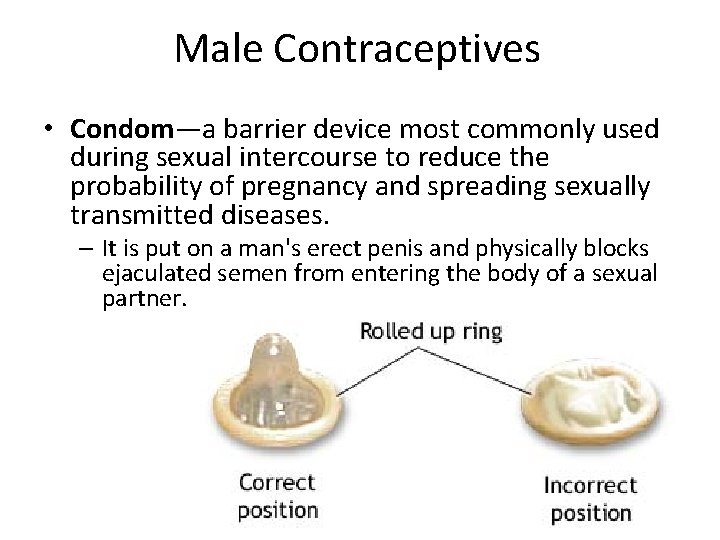 Male Contraceptives • Condom—a barrier device most commonly used during sexual intercourse to reduce Male Contraceptives • Condom—a barrier device most commonly used during sexual intercourse to reduce