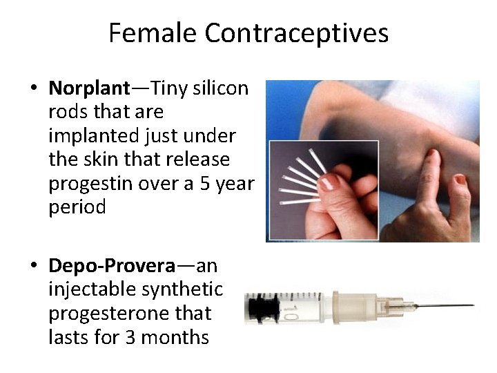 Female Contraceptives • Norplant—Tiny silicon rods that are implanted just under the skin that Female Contraceptives • Norplant—Tiny silicon rods that are implanted just under the skin that