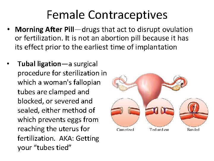 Female Contraceptives • Morning After Pill—drugs that act to disrupt ovulation or fertilization. It Female Contraceptives • Morning After Pill—drugs that act to disrupt ovulation or fertilization. It