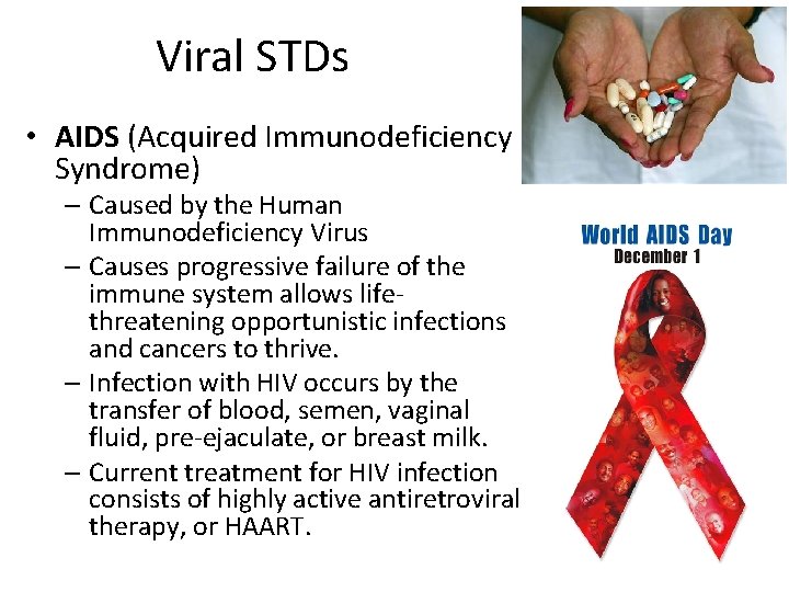 Viral STDs • AIDS (Acquired Immunodeficiency Syndrome) – Caused by the Human Immunodeficiency Virus Viral STDs • AIDS (Acquired Immunodeficiency Syndrome) – Caused by the Human Immunodeficiency Virus