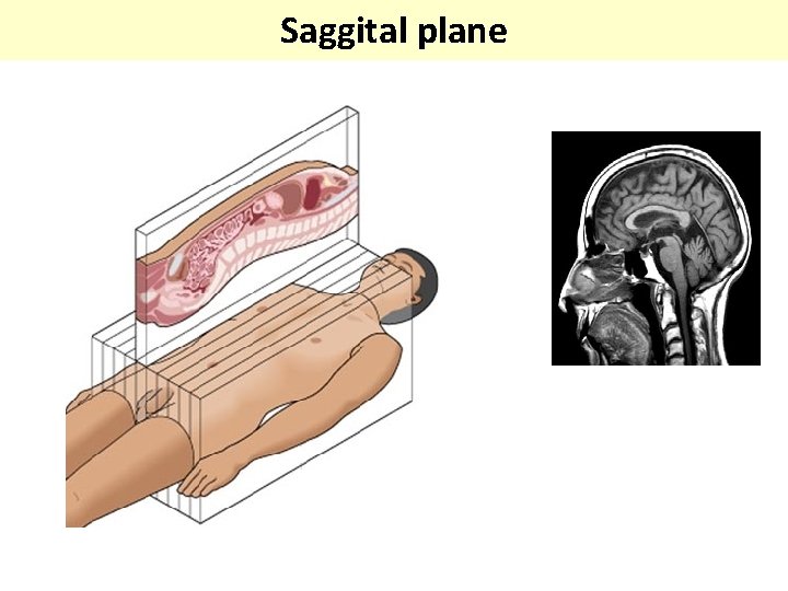 Saggital plane 