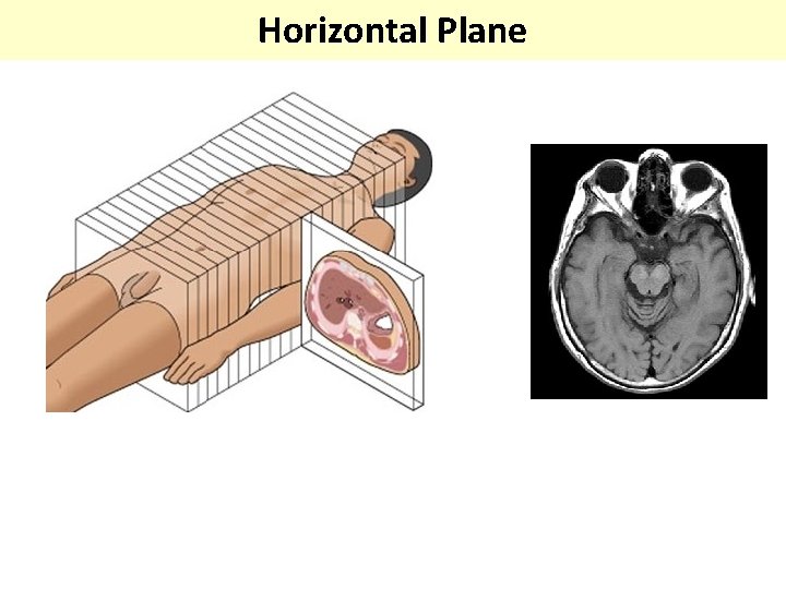 Horizontal Plane 