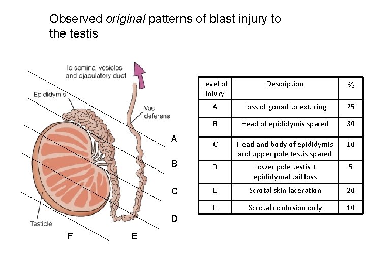Observed original patterns of blast injury to the testis Level of injury Description %