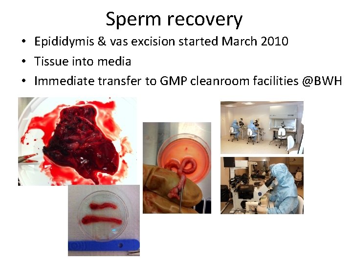 Sperm recovery • Epididymis & vas excision started March 2010 • Tissue into media