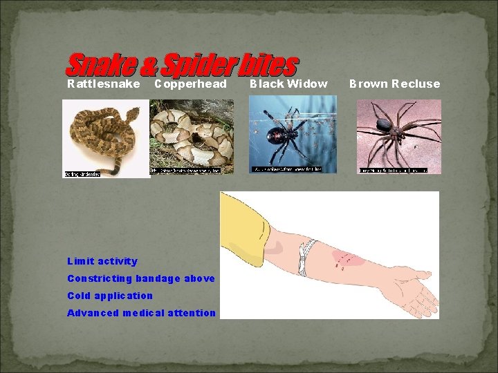 Snake & Spider bites Rattlesnake Copperhead Limit activity Constricting bandage above Cold application Advanced